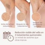 Depiladora Philips Lumea Bri940/00 Definitiva Ipl Cuerpo - Imagen 2